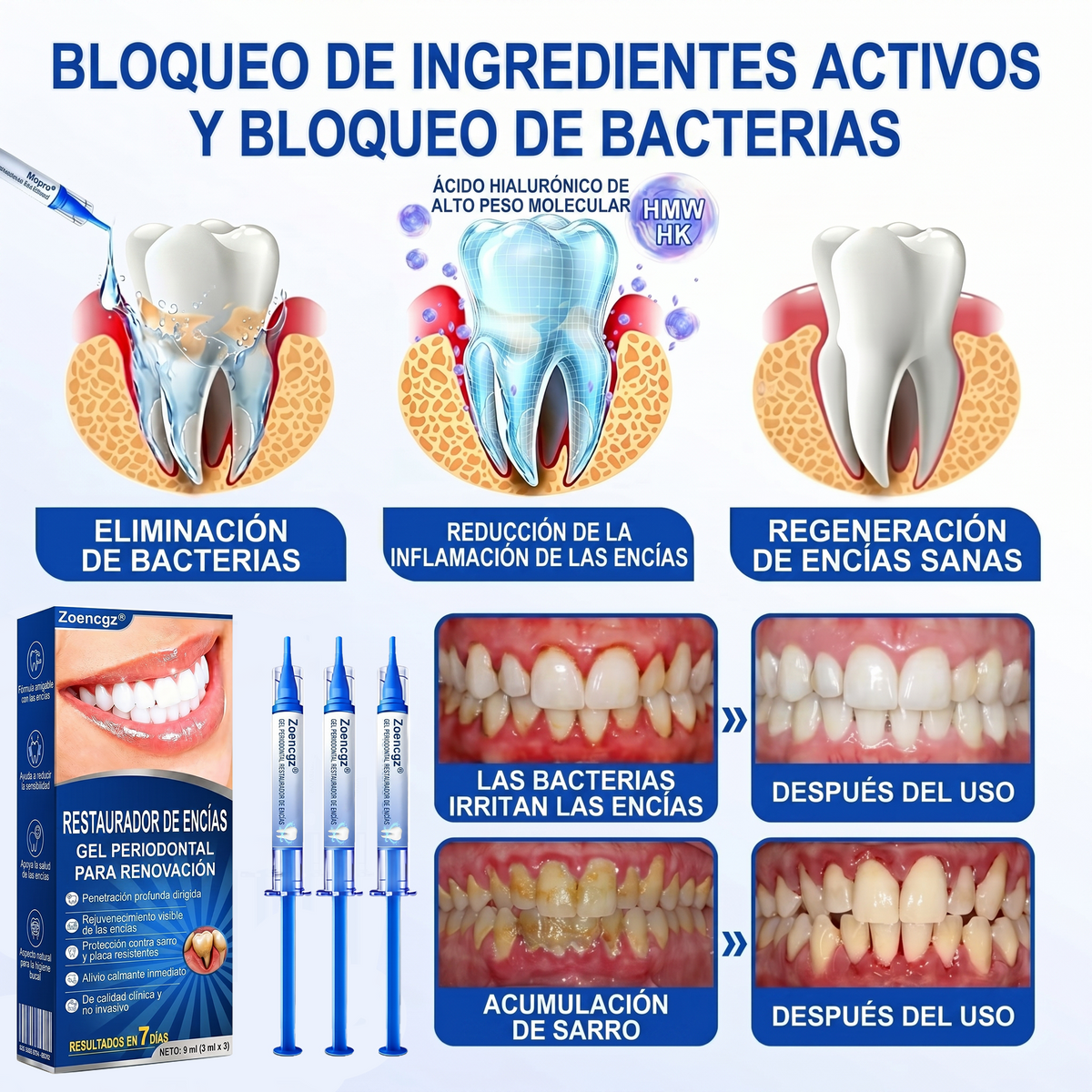 Zoencgz® 🦷🧴 Gel antibacteriano para la regeneración de las encías | Resultados visibles en 7 días