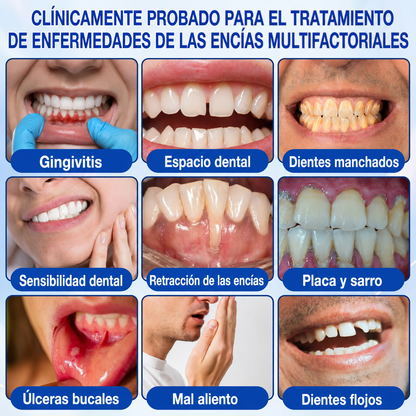 🇪🇸👨‍⚕️✅🦷HEATWOLF® GumRevive Gel Reparador Periodontal