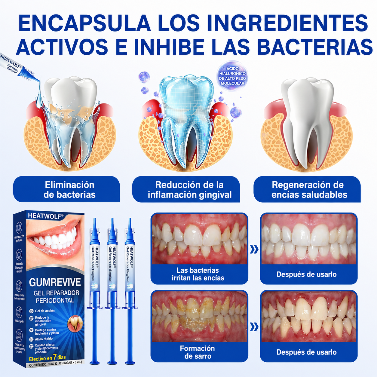🇪🇸👨‍⚕️✅🦷HEATWOLF® GumRevive Gel Reparador Periodontal