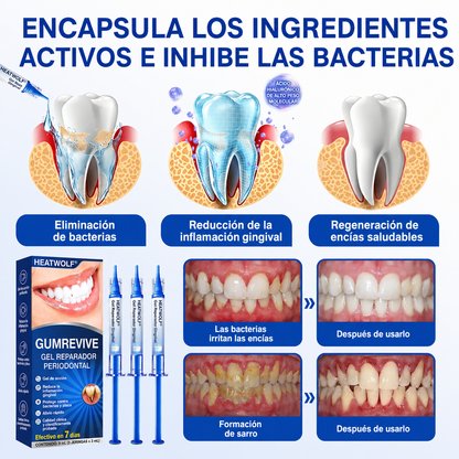 🇪🇸👨‍⚕️✅🦷HEATWOLF® GumRevive Gel Reparador Periodontal