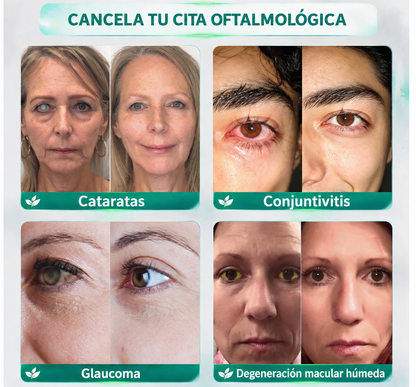 CureVivo® Nano Clear Vision Suero en Rodillo Ocular – Alivio Ocular Profesional y Soporte para la Visión