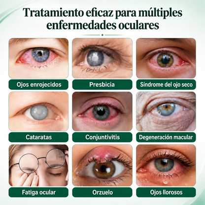 CureVivo® Nano Clear Vision Suero en Rodillo Ocular – Alivio Ocular Profesional y Soporte para la Visión