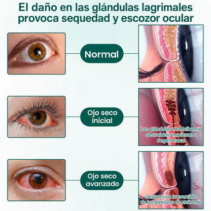 CureVivo® Nano Clear Vision Suero en Rodillo Ocular – Alivio Ocular Profesional y Soporte para la Visión