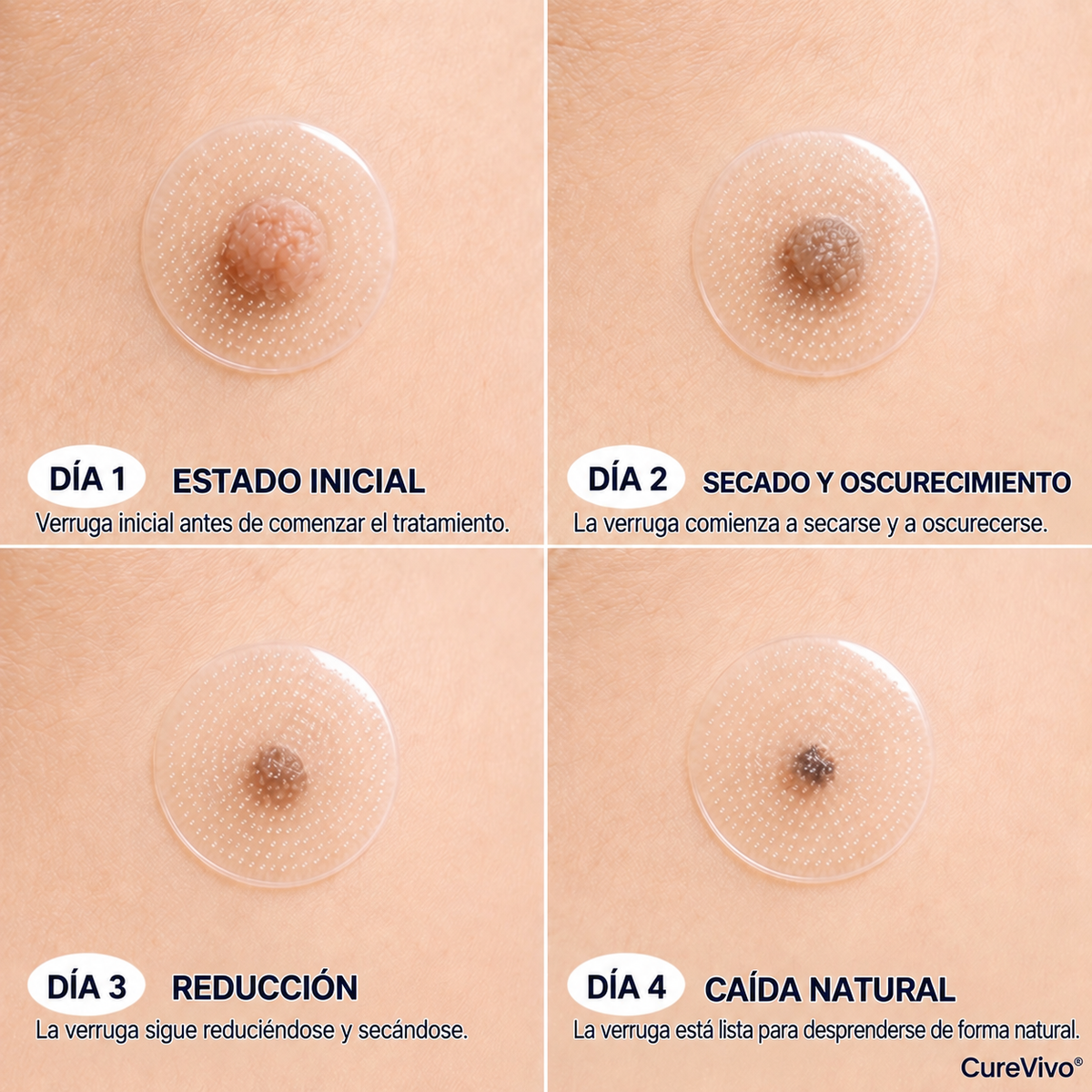 Tienda Oficial | CureVivo® Parche Cutáneo de Microagujas 01