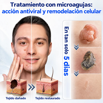 Tienda Oficial | CureVivo® Parche Cutáneo de Microagujas 01