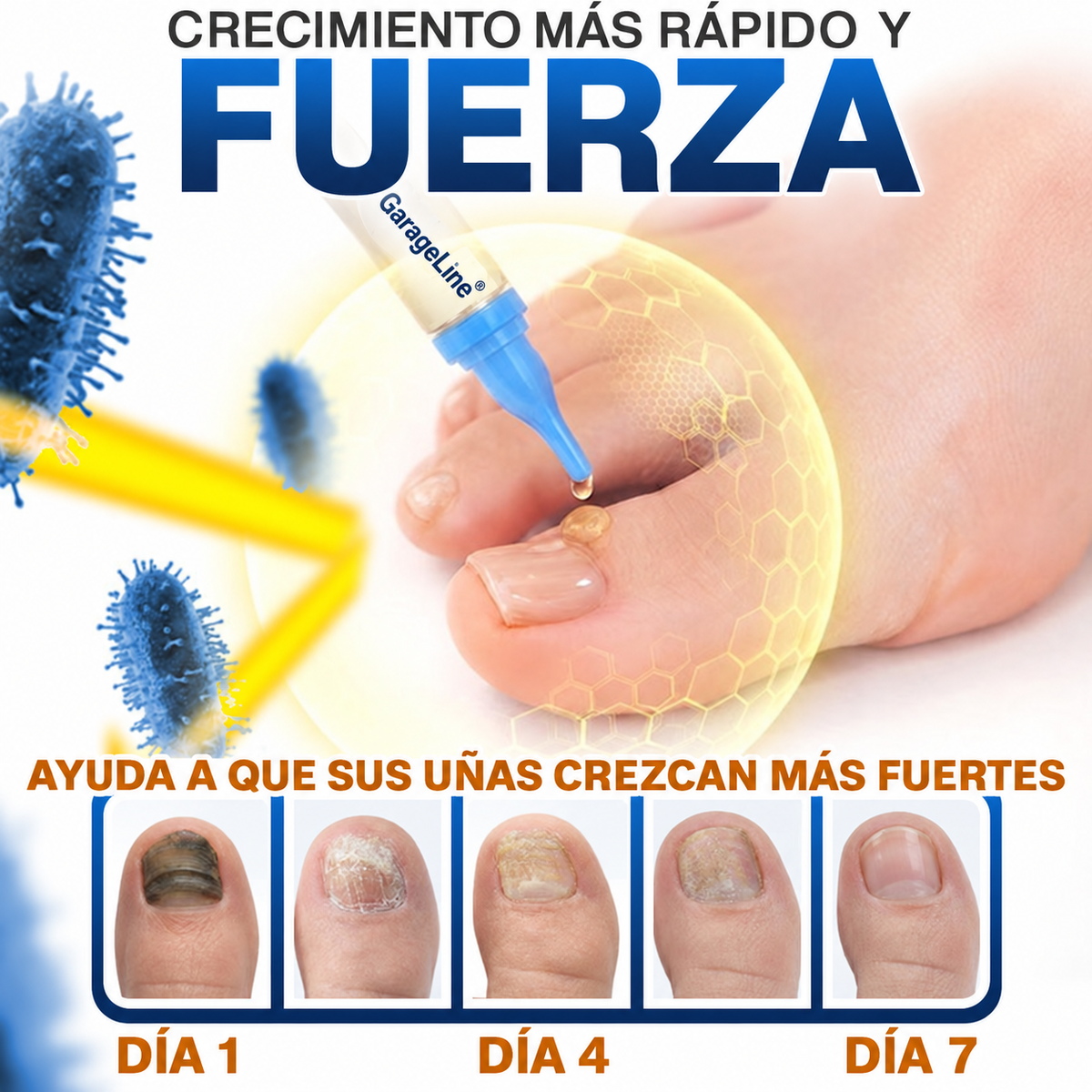 GarageLine® Tratamiento para Uñas con Veneno de Abeja Contra Hongos