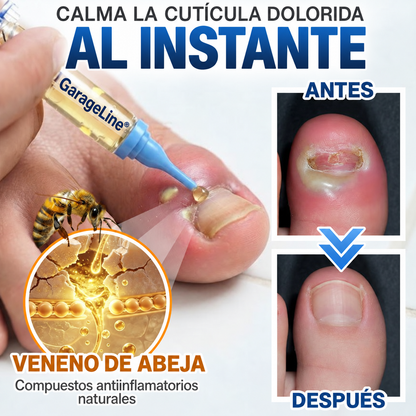 GarageLine® Tratamiento para Uñas con Veneno de Abeja Contra Hongos