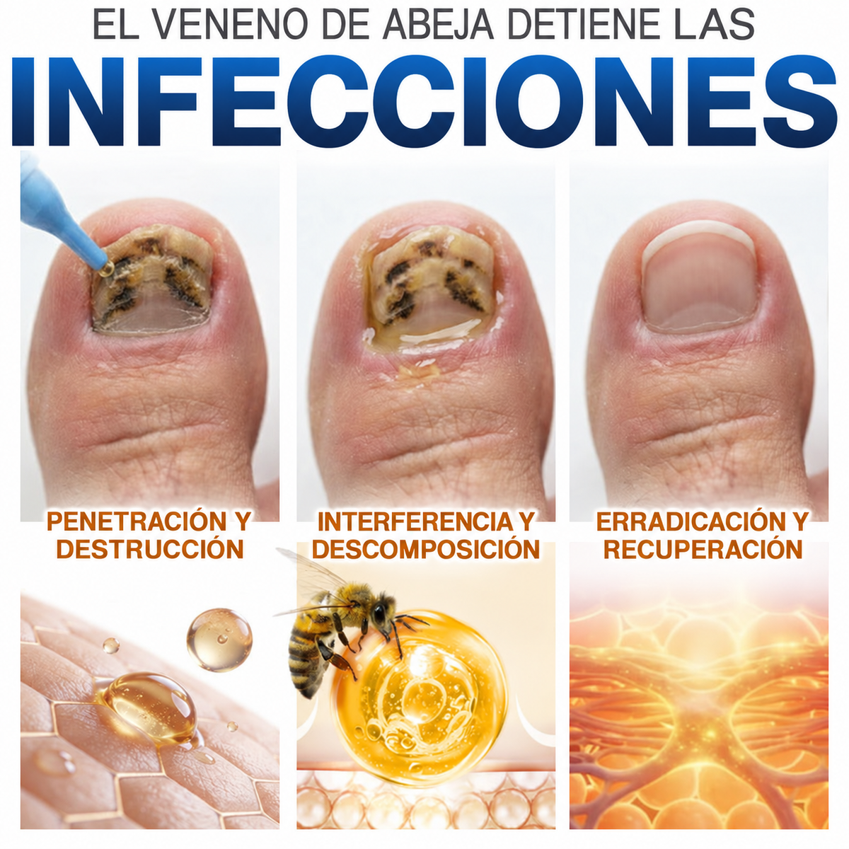 GarageLine® Tratamiento para Uñas con Veneno de Abeja Contra Hongos