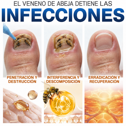 GarageLine® Tratamiento para Uñas con Veneno de Abeja Contra Hongos