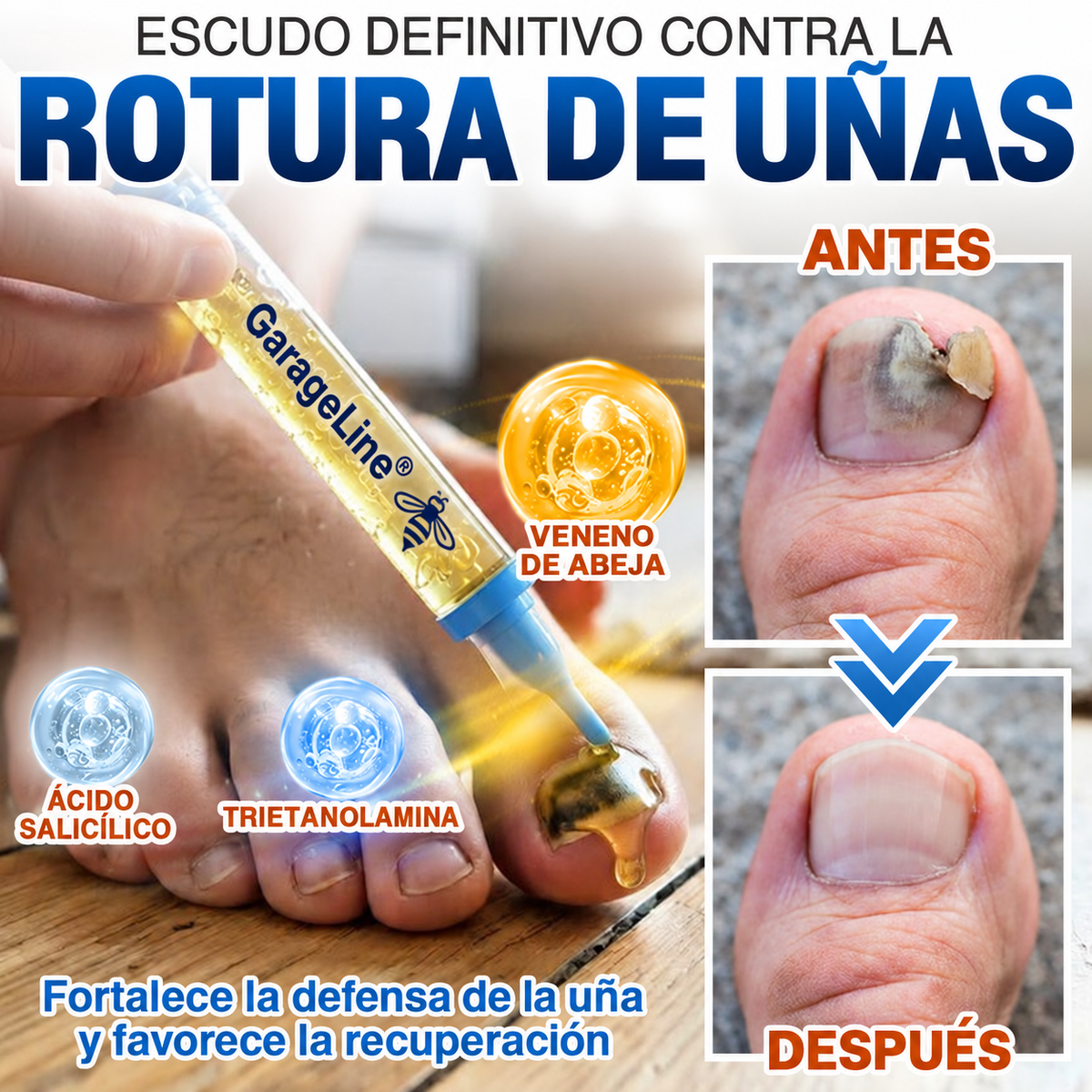 GarageLine® Tratamiento para Uñas con Veneno de Abeja Contra Hongos