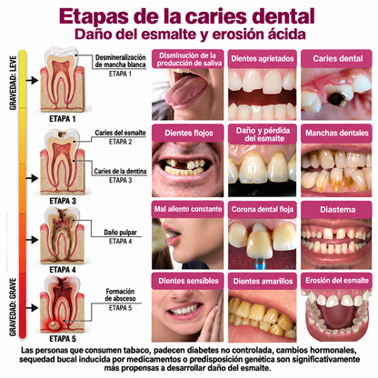 HEATWOLF® DenPerm Gel Rellenador Natural de Esmalte para Reparar Caries