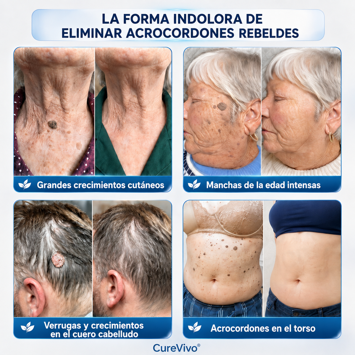𝐏𝐢𝐜𝐝𝐨® 𝟕-𝐓𝐚𝐠𝐞 𝐇𝐚𝐮𝐭𝐚𝐧𝐡ä𝐧𝐠𝐬𝐞𝐥- & 𝐅𝐥𝐞𝐜𝐤𝐞𝐧-𝐄𝐧𝐭𝐟𝐞𝐫𝐧𝐮𝐧𝐠𝐬𝐜𝐫𝐞𝐦𝐞 (𝐒𝐜𝐡𝐦𝐞𝐫𝐳𝐟𝐫𝐞𝐢𝐞 𝐅𝐨𝐫𝐦𝐞𝐥 – 𝐨𝐡𝐧𝐞 𝐍𝐚𝐫𝐛𝐞𝐧🚗
