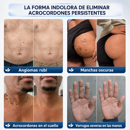 𝐏𝐢𝐜𝐝𝐨® 𝟕-𝐓𝐚𝐠𝐞 𝐇𝐚𝐮𝐭𝐚𝐧𝐡ä𝐧𝐠𝐬𝐞𝐥- & 𝐅𝐥𝐞𝐜𝐤𝐞𝐧-𝐄𝐧𝐭𝐟𝐞𝐫𝐧𝐮𝐧𝐠𝐬𝐜𝐫𝐞𝐦𝐞 (𝐒𝐜𝐡𝐦𝐞𝐫𝐳𝐟𝐫𝐞𝐢𝐞 𝐅𝐨𝐫𝐦𝐞𝐥 – 𝐨𝐡𝐧𝐞 𝐍𝐚𝐫𝐛𝐞𝐧🚗
