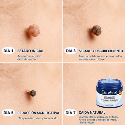 𝐏𝐢𝐜𝐝𝐨® 𝟕-𝐓𝐚𝐠𝐞 𝐇𝐚𝐮𝐭𝐚𝐧𝐡ä𝐧𝐠𝐬𝐞𝐥- & 𝐅𝐥𝐞𝐜𝐤𝐞𝐧-𝐄𝐧𝐭𝐟𝐞𝐫𝐧𝐮𝐧𝐠𝐬𝐜𝐫𝐞𝐦𝐞 (𝐒𝐜𝐡𝐦𝐞𝐫𝐳𝐟𝐫𝐞𝐢𝐞 𝐅𝐨𝐫𝐦𝐞𝐥 – 𝐨𝐡𝐧𝐞 𝐍𝐚𝐫𝐛𝐞𝐧🚗