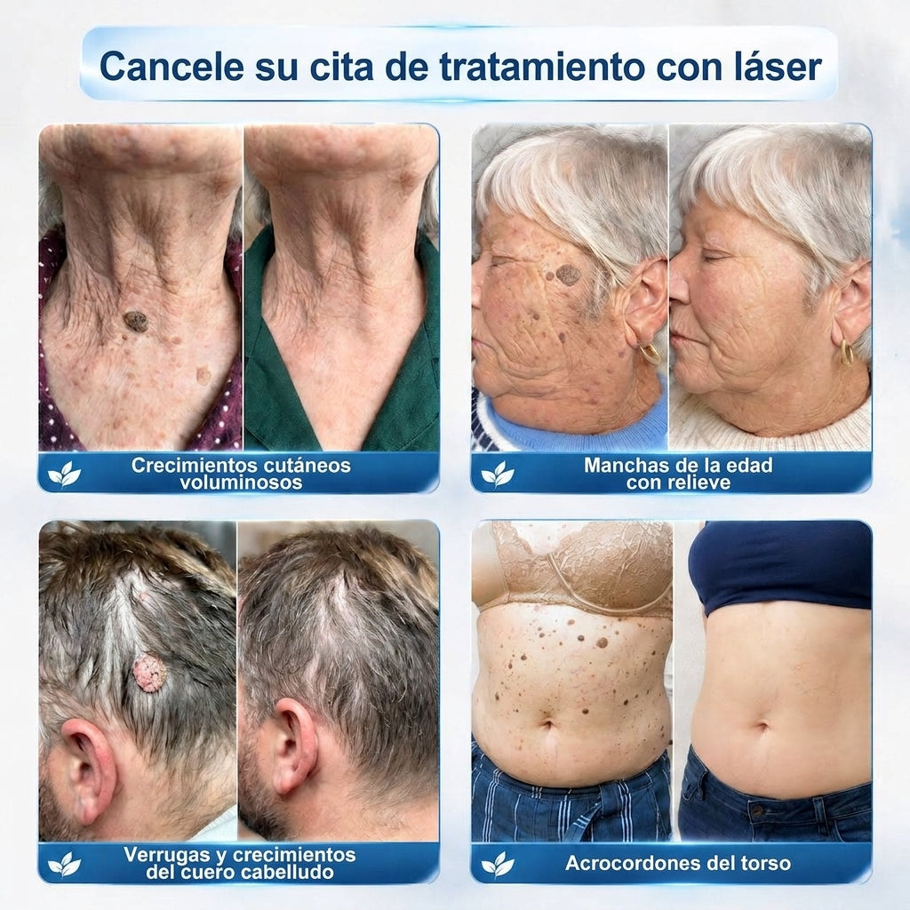 Offizieller Markenstore |✅Trilumia® 7-𝑻𝒂𝒈𝒆 𝑯𝒂𝒖𝒕𝒂𝒏𝒉ä𝒏𝒈𝒔𝒆𝒍- & 𝑭𝒍𝒆𝒄𝒌𝒆𝒏𝒆𝒏𝒕𝒇𝒆𝒓𝒏𝒆𝒓(Schmerzfreier Rollerball – Keine Narbenbildung)03